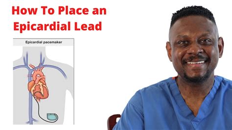 surgical epicardial lead placement